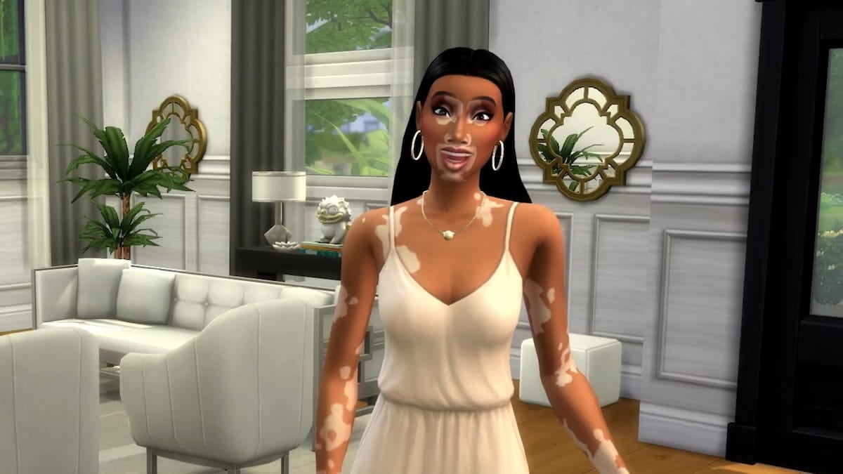 The Sims 4 Delivery Express vitiligo features
