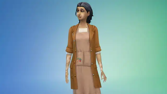 Sims 4 Vitiligo skin feature in Create a Sim