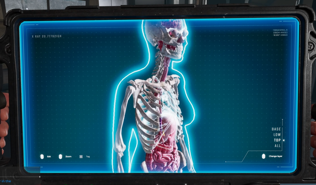 Bottom layer in X-Ray