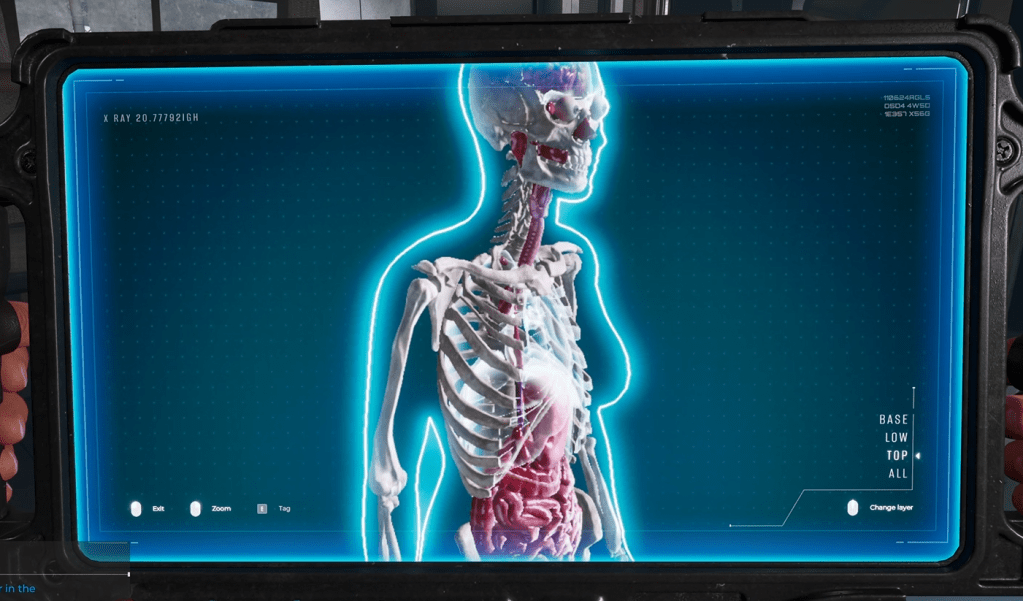 Bottom layer in X-Ray