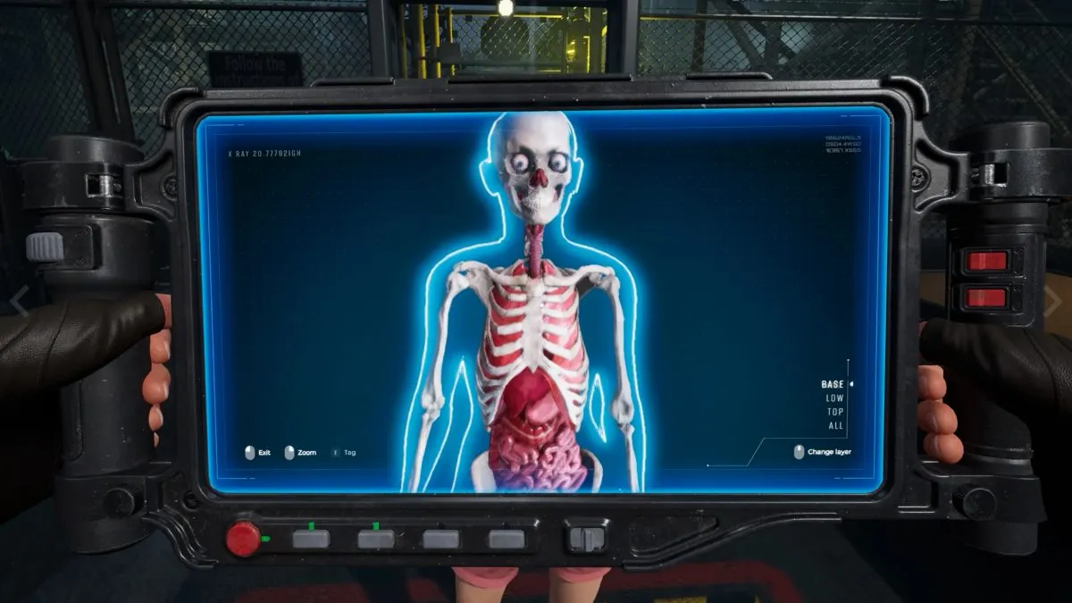 X-Ray image of survivor